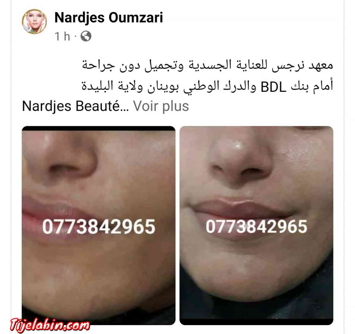 نتواياج دوبو - Bouinan, Blida - Tijelabin