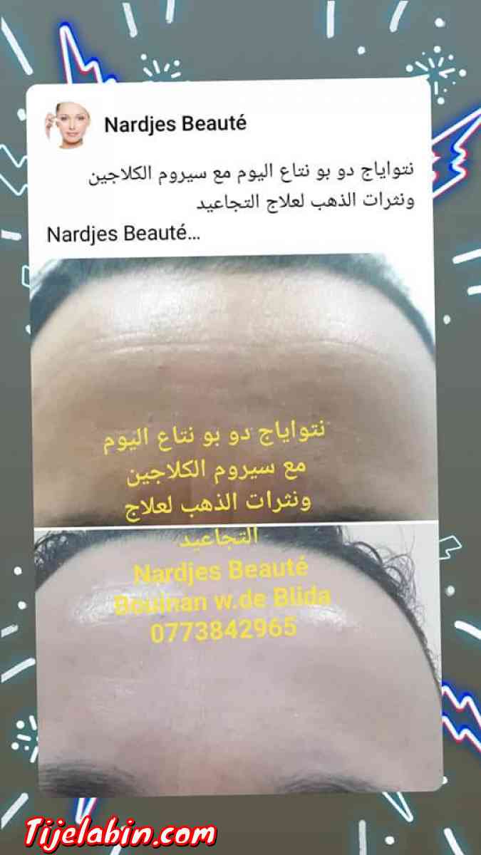 نتواياج دوبو