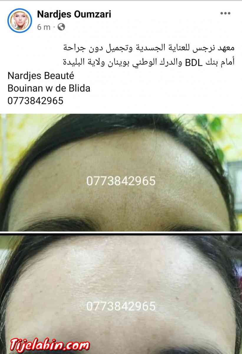 نتواياج دوبو - Bouinan, Blida - Tijelabin