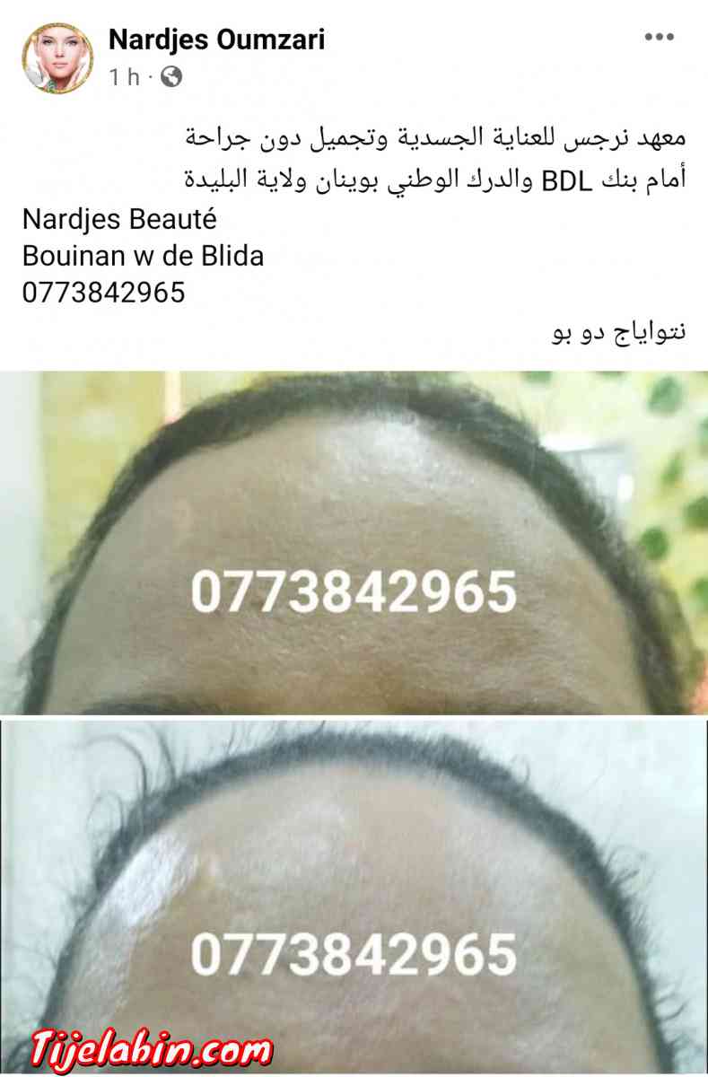 نتواياج دوبو - Bouinan, Blida - Tijelabin