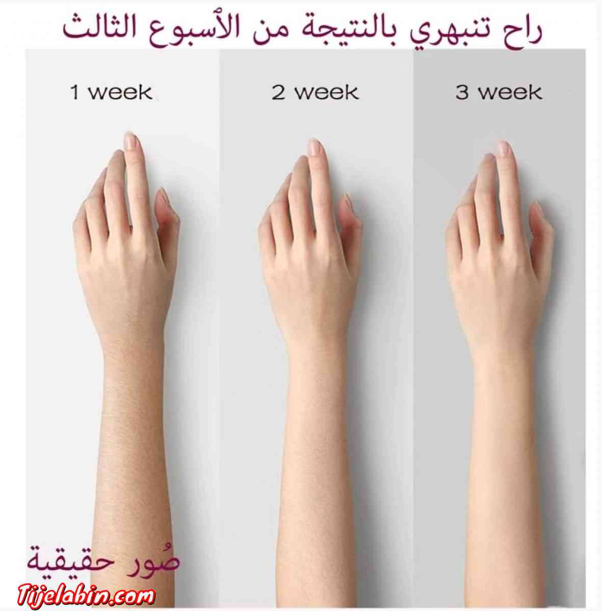 جهاز نزع الشعر الفوري من شركة MAC - Alger Centre, Alger - Tijelabin