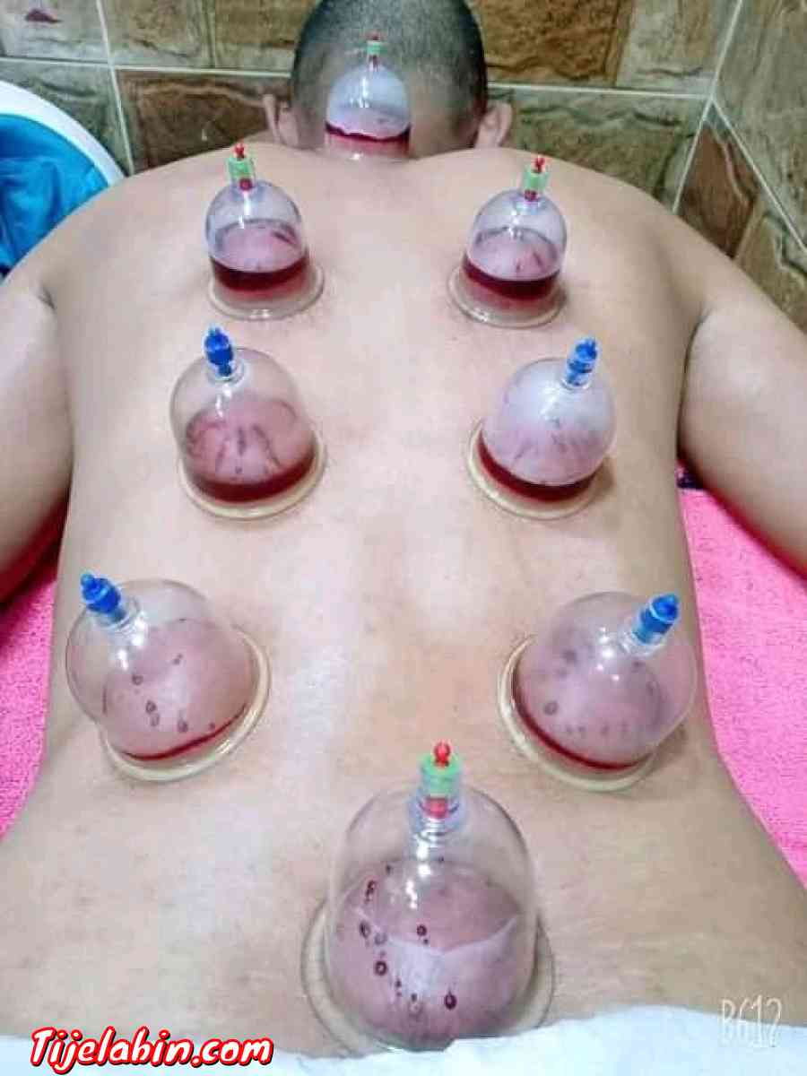 الطب البديل - Bejaia, Béjaïa