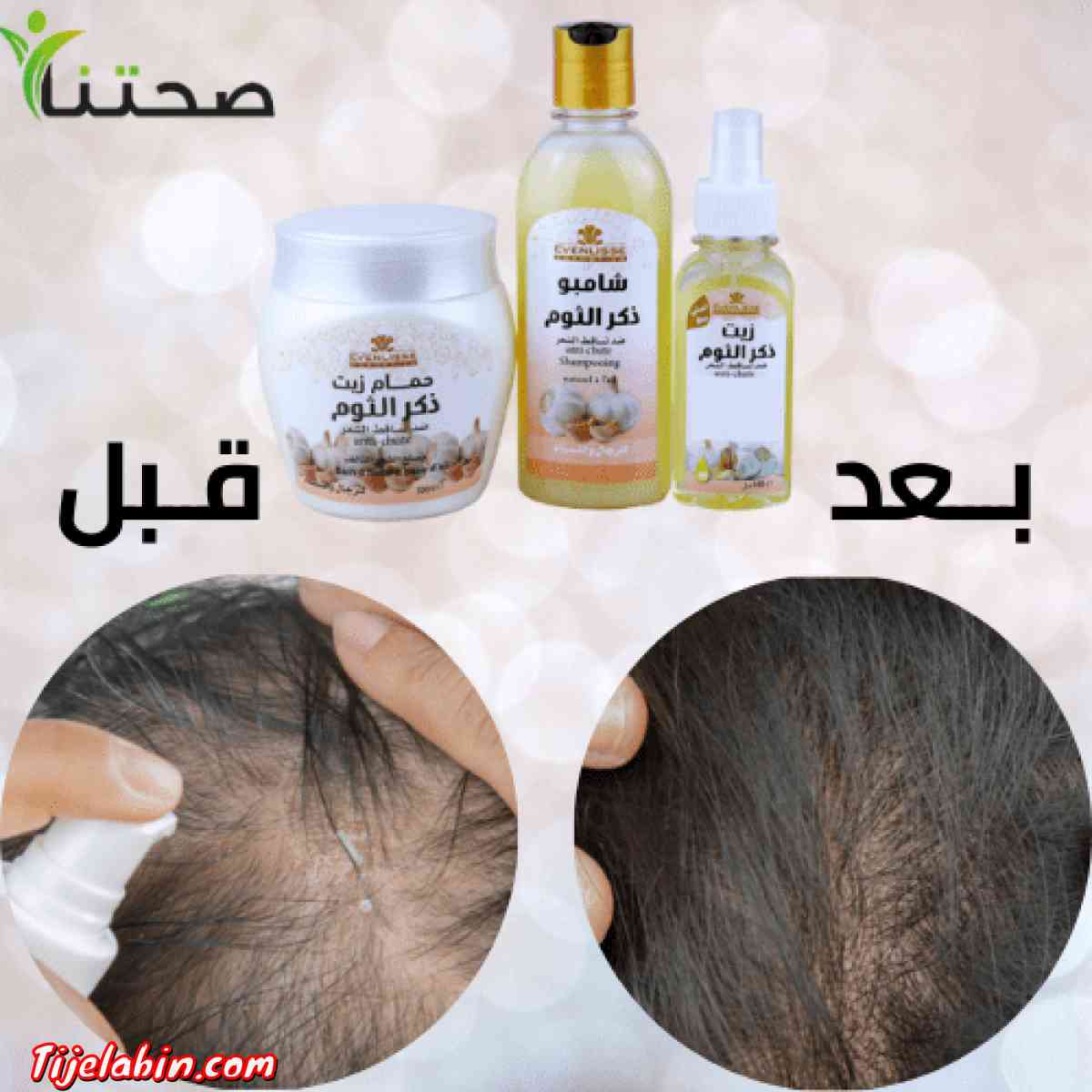 مع منتجات ايفنليس ، قولوا وداعا الشعر المترهل والمتساقط - Bab Azzouar, Alger - Tijelabin