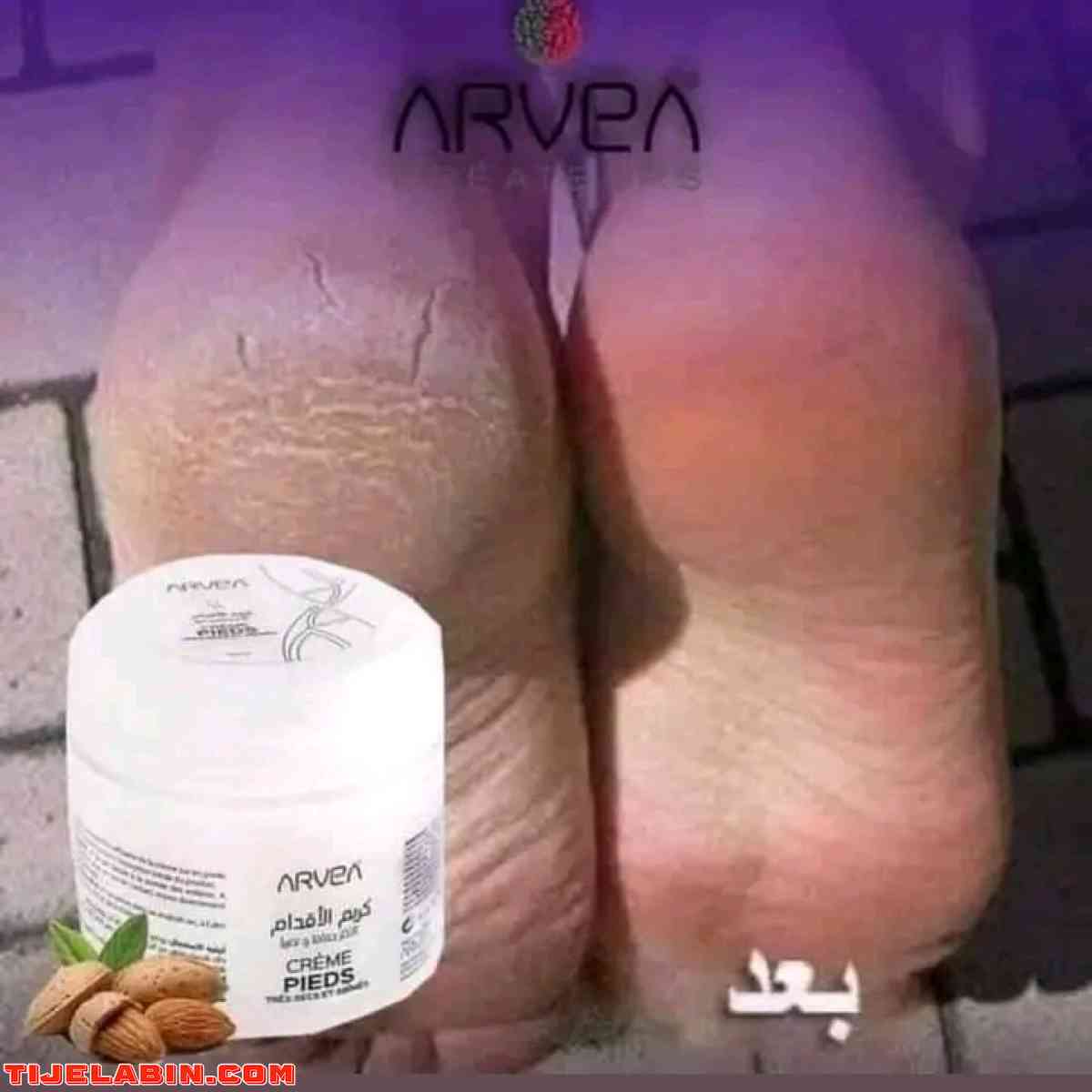 كريم الاقدام ارفيا - Ngaous, Batna