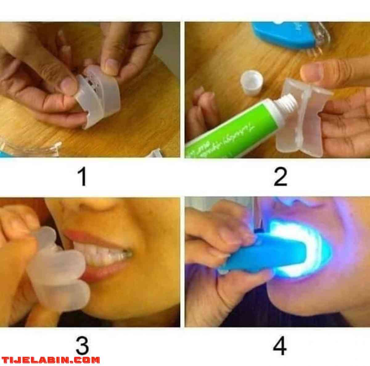 جهاز تبييض الاسنان الطبي بالليزر - Alger Centre, Alger