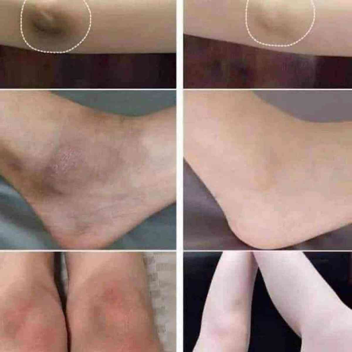 ماجيك دريم بلسم بخاخ لتفتيح البشرة Magic dream - Alger Centre, Alger - Tijelabin