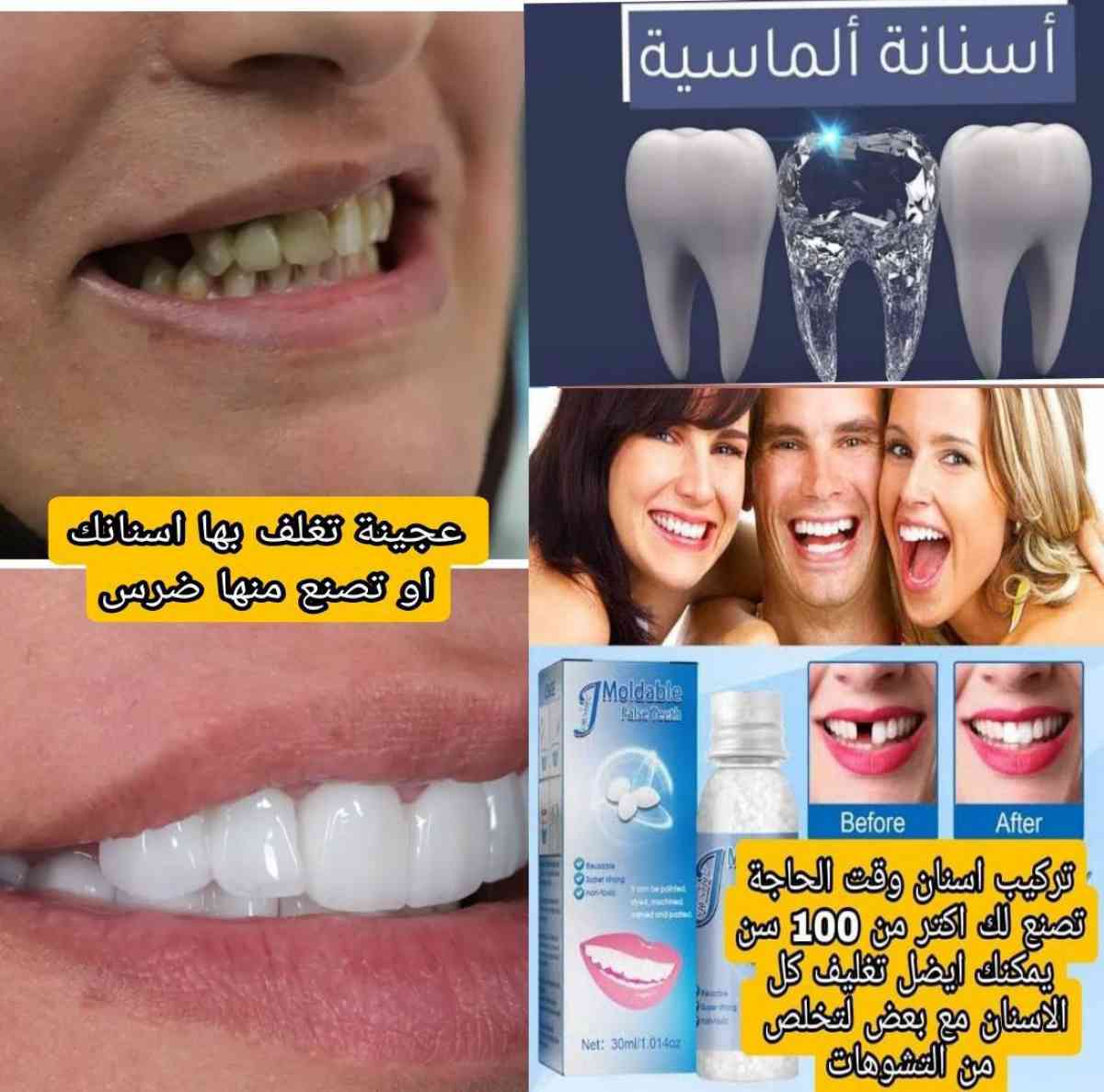 عجينة الأسنان السحرية لتعويض الأسنان المتساقطة أو المنكسرة