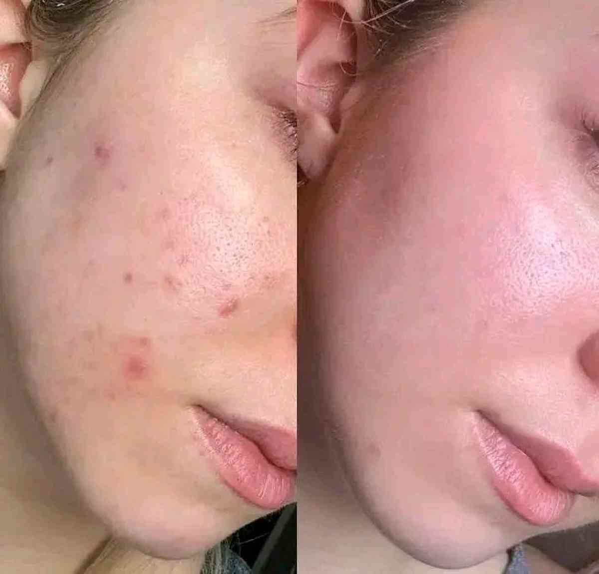 باك فيتامين سي - Alger Centre, Alger - Tijelabin