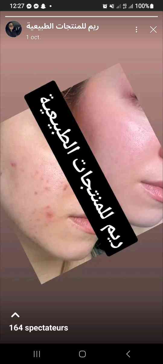 باقة فيتامين سي - Alger Centre, Alger - Tijelabin