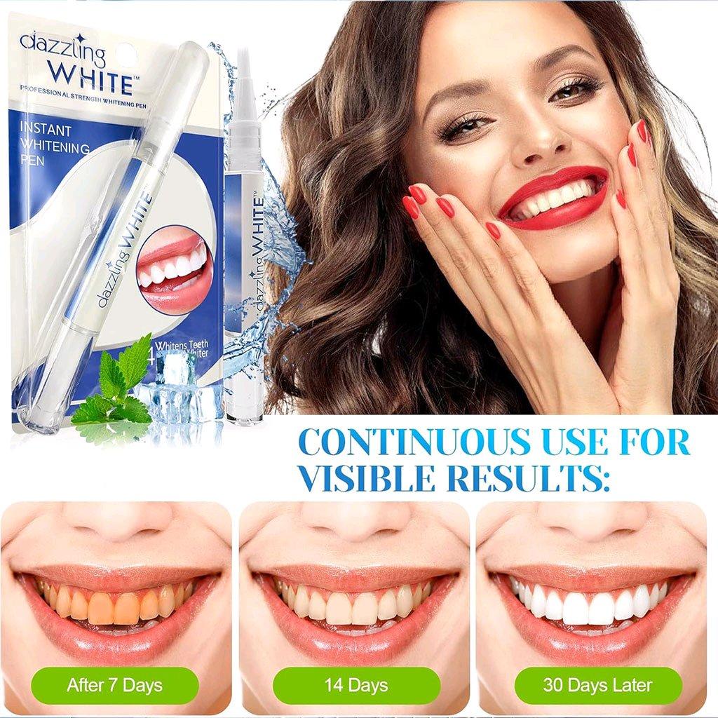 قلم تبييض الأسنان - Alger Centre, Alger - Tijelabin