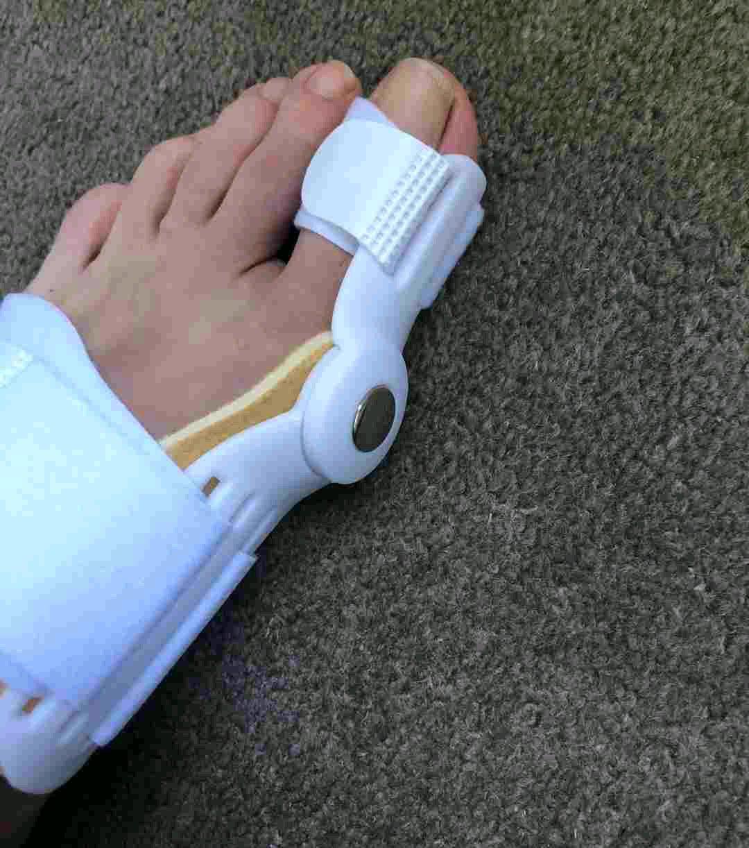 Hallux Valgus Schiene أداة تصحيح وضعية أصبع القدم - Alger Centre, Alger - Tijelabin