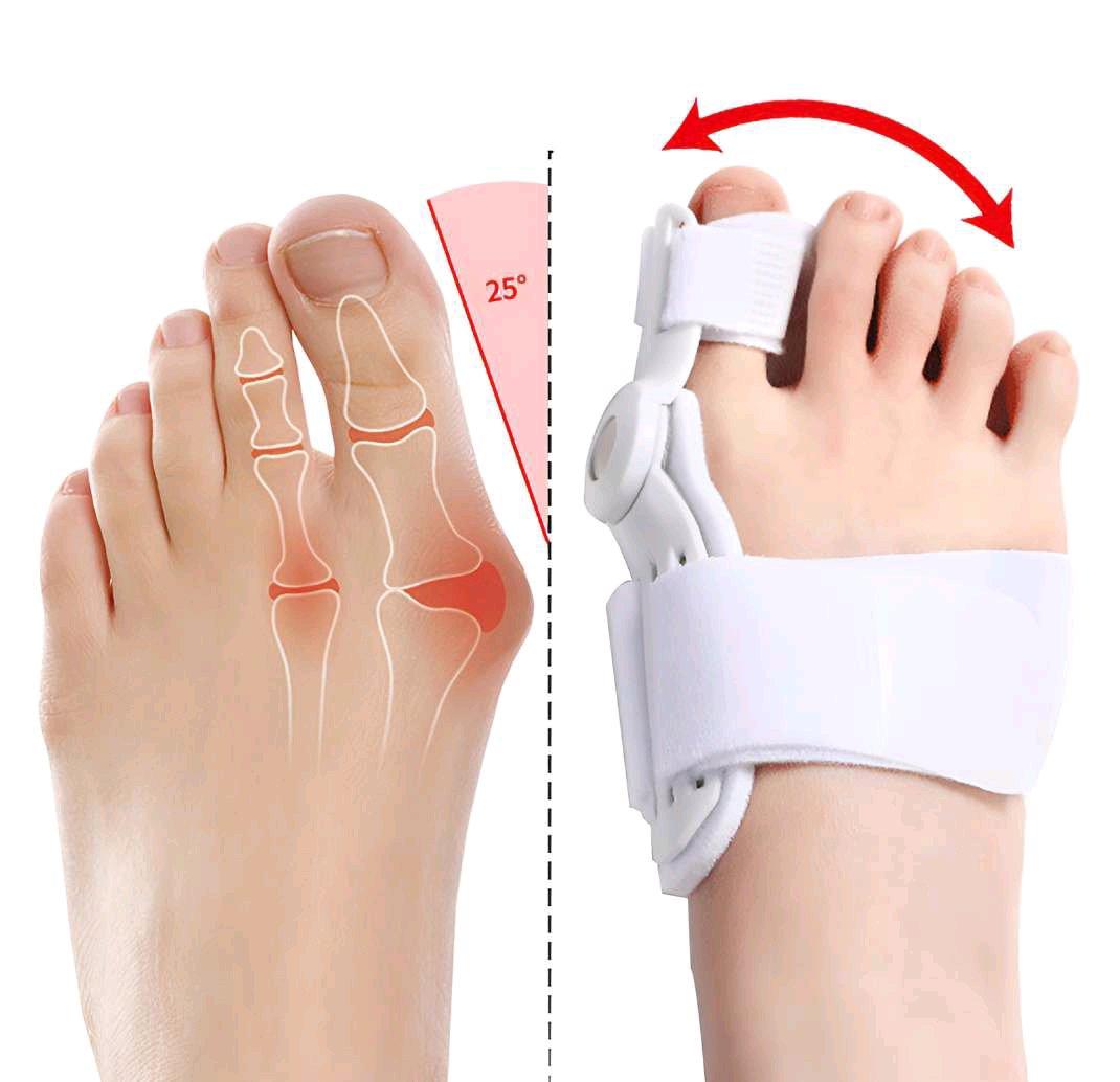 Hallux Valgus Schiene أداة تصحيح وضعية أصبع القدم - Alger Centre, Alger - Tijelabin